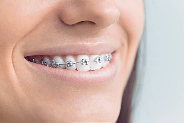 Best Full Mouth Reconstruction  in Ossian, IN